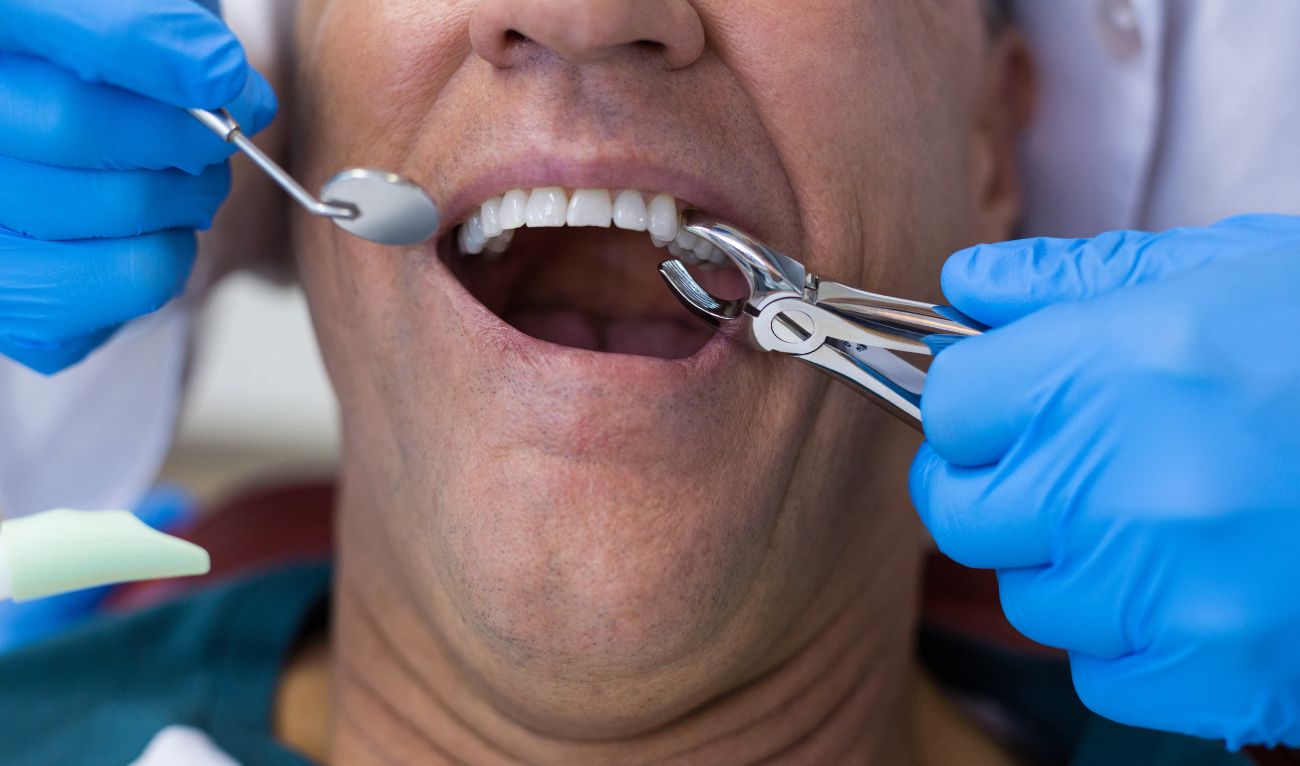 Остался осколок после удаления зуба – что делать?