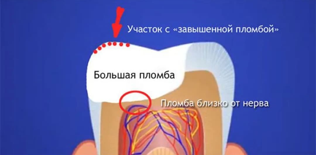 Чувствительные зубы: причины и лечение